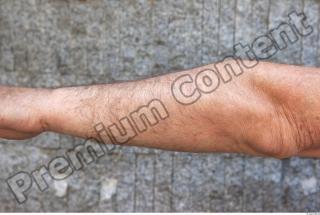 Forearm texture of street references 401 0001